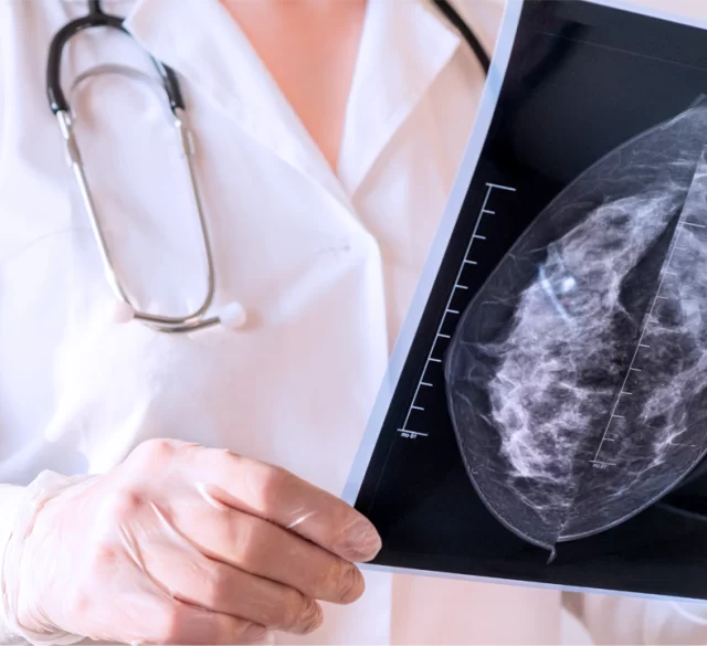 МРТ молочних залоз: чому це важливо?